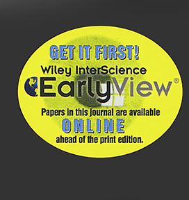 Gr&ouml;&szlig;ere Abbildung Sticker "EarlyView"